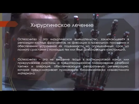 Хирургическое лечение Остеосинтез - это хирургическое вмешательство, заключающееся в репозиции костных