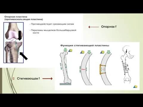 Стягивающая f Опорная f