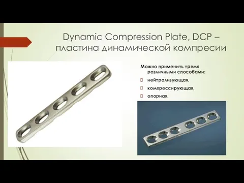 Dynamic Compression Plate, DCP – пластина динамической компресии Можно применить тремя различными способами: нейтрализующая, компрессирующая, опорная.