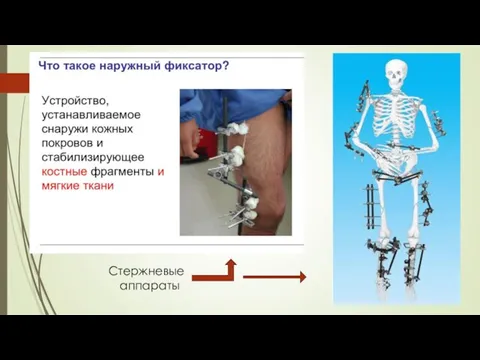 Стержневые аппараты