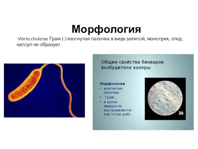 Морфология Vibrio cholerae Грам (-) изогнутая палочка в виде запятой, монотрих, спор, капсул не образует.