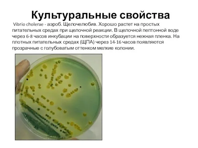 Культуральные свойства Vibrio cholerae - аэроб. Щелочелюбив. Хорошо растет на простых