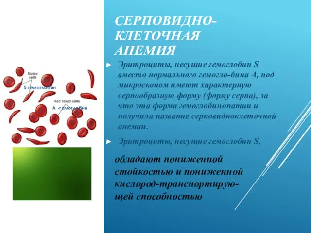 СЕРПОВИДНО-КЛЕТОЧНАЯ АНЕМИЯ Эритроциты, несущие гемоглобин S вместо нормального гемогло-бина А, под