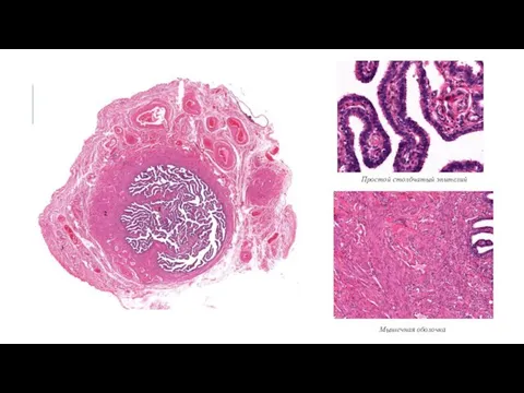 Простой столбчатый эпителий Мышечная оболочка