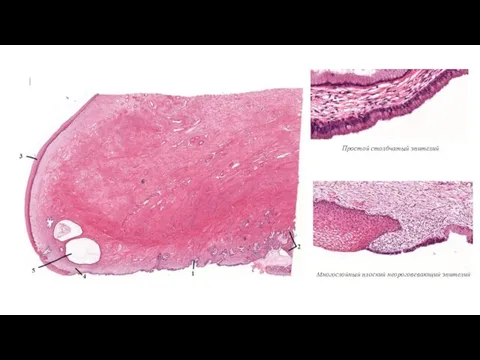 Простой столбчатый эпителий Многослойный плоский неороговевающий эпителий