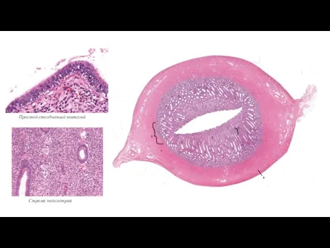 Простой столбчатый эпителий Строма эндометрия