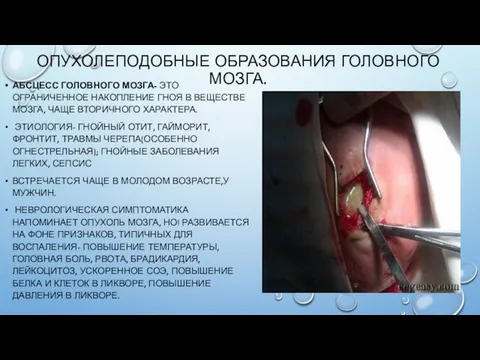 ОПУХОЛЕПОДОБНЫЕ ОБРАЗОВАНИЯ ГОЛОВНОГО МОЗГА. АБСЦЕСС ГОЛОВНОГО МОЗГА- ЭТО ОГРАНИЧЕННОЕ НАКОПЛЕНИЕ ГНОЯ