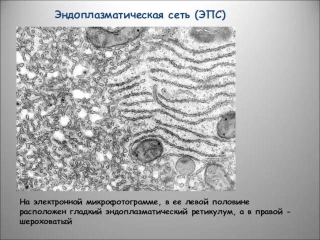 Эндоплазматическая сеть (ЭПС) На электронной микрофотограмме, в ее левой половине расположен