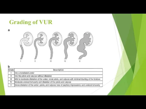 Grading of VUR