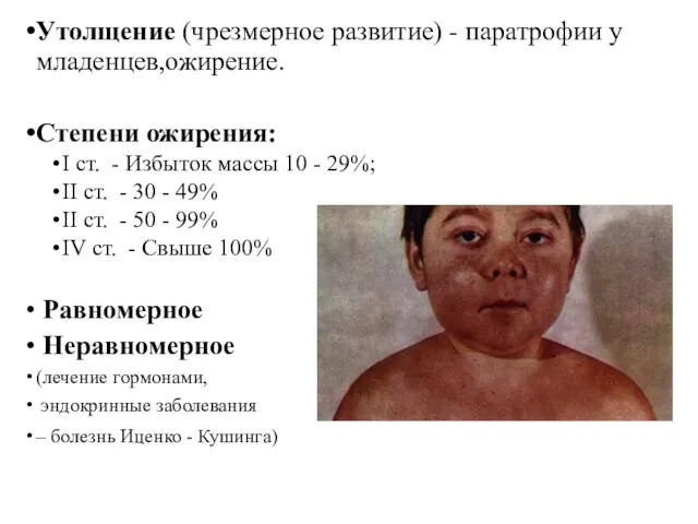 Утолщение (чрезмерное развитие) - паратрофии у младенцев,ожирение. Степени ожирения: I ст.