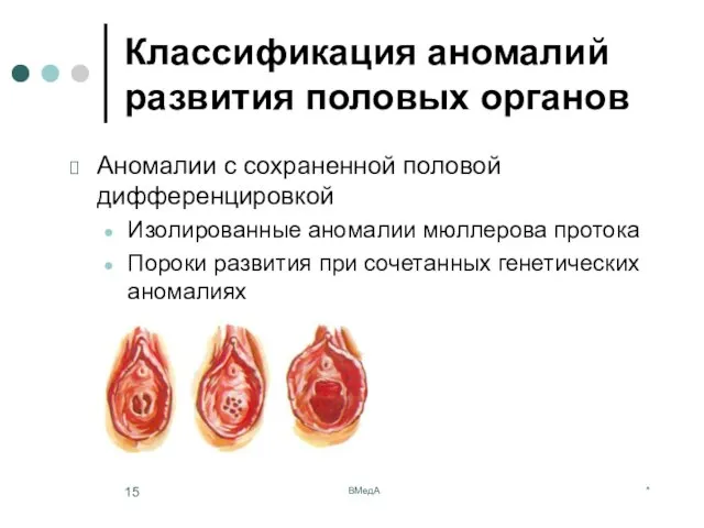 * ВМедА Классификация аномалий развития половых органов Аномалии с сохраненной половой