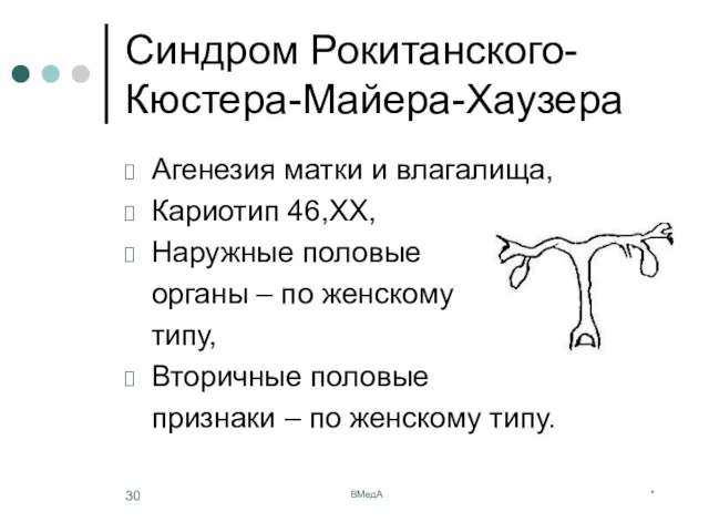 * ВМедА Синдром Рокитанского-Кюстера-Майера-Хаузера Агенезия матки и влагалища, Кариотип 46,ХХ, Наружные