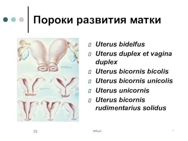* ВМедА Пороки развития матки Uterus bidelfus Uterus duplex et vagina