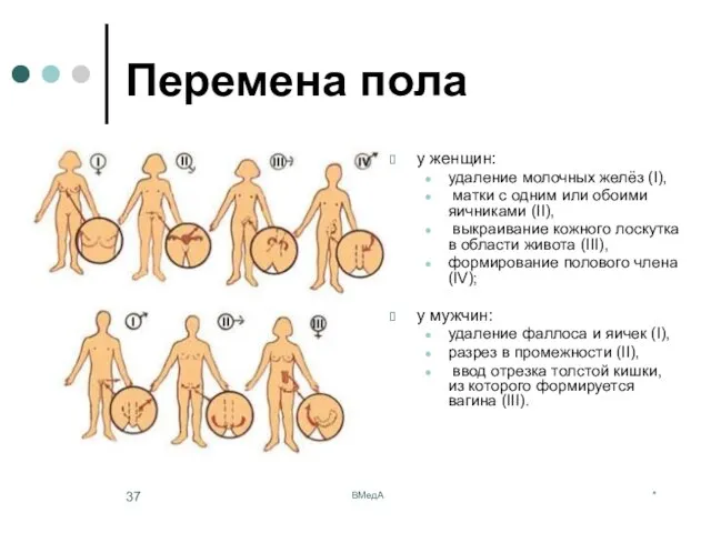 * ВМедА Перемена пола у женщин: удаление молочных желёз (I), матки