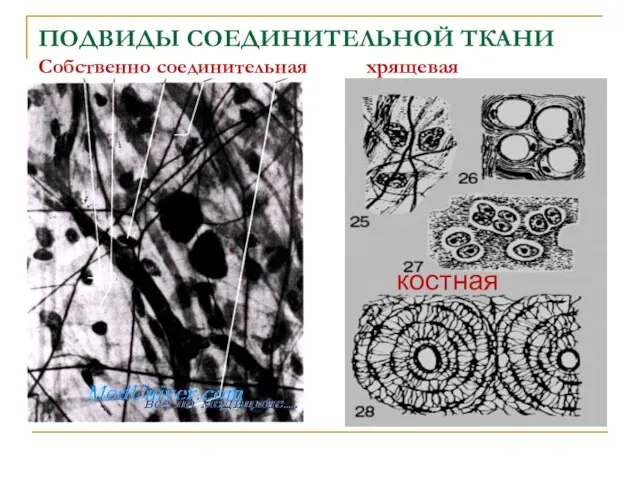 ПОДВИДЫ СОЕДИНИТЕЛЬНОЙ ТКАНИ Собственно соединительная хрящевая костная