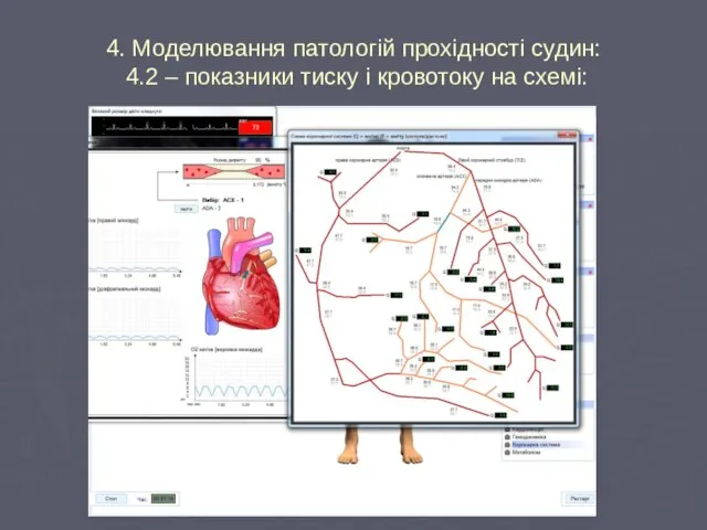 4. Моделювання патологій прохідності судин: 4.2 – показники тиску і кровотоку на схемі: