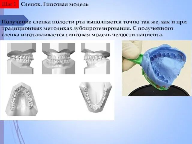 Слепок. Гипсовая модель Получение слепка полости рта выполняется точно так же,