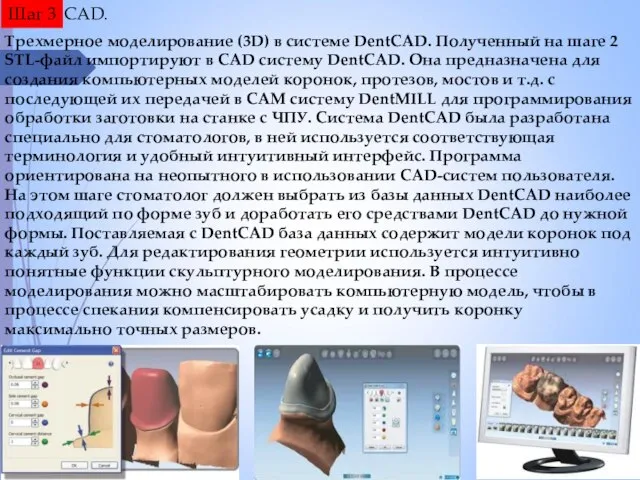 CAD. Шаг 3 Трехмерное моделирование (3D) в системе DentCAD. Полученный на