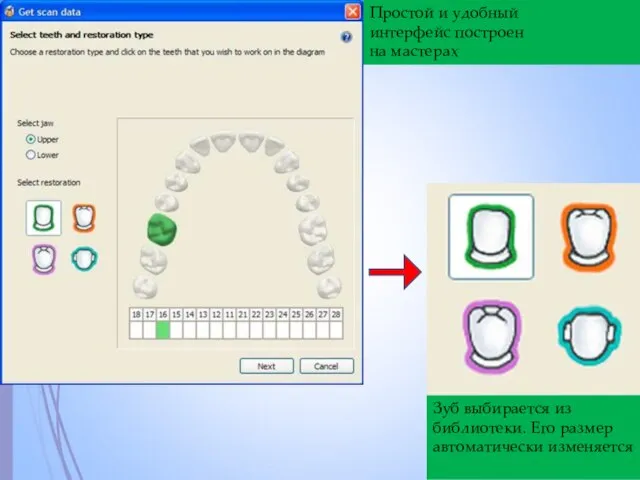 Простой и удобный интерфейс построен на мастерах Зуб выбирается из библиотеки. Его размер автоматически изменяется
