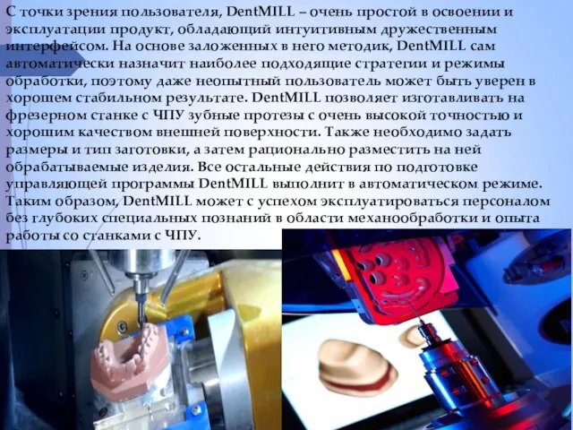 C точки зрения пользователя, DentMILL – очень простой в освоении и