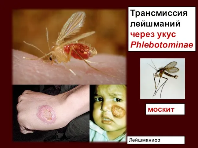 Лейшманиоз Трансмиссия лейшманий через укус Phlebotominae москит