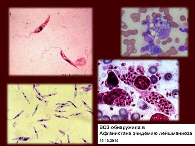 ВОЗ обнаружила в Афганистане эпидемию лейшманиоза 19.10.2010