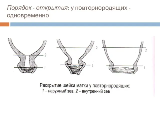 Порядок - открытия: у повторнородящих - одновременно