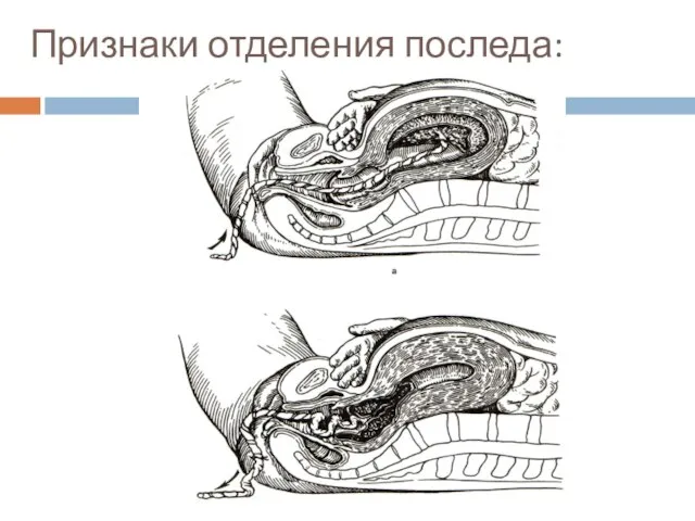 Признаки отделения последа: