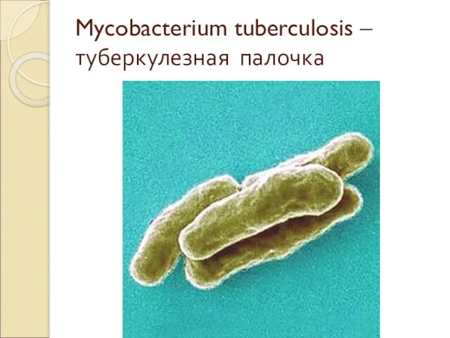 Mycobacterium tuberculosis – туберкулезная палочка