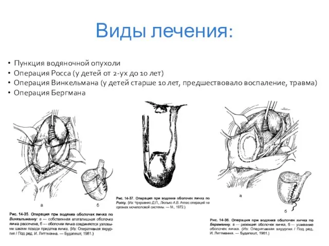 Виды лечения: Пункция водяночной опухоли Операция Росса (у детей от 2-ух