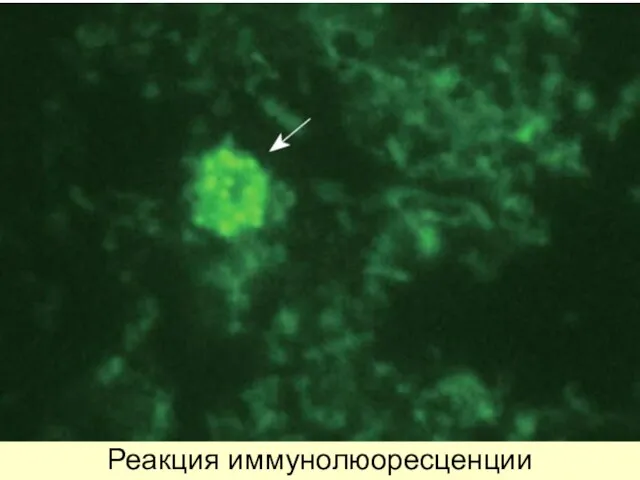 Реакция иммунолюоресценции