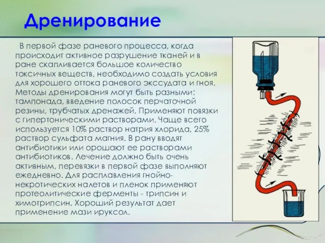 Дренирование В первой фазе раневого процесса, когда происходит активное разрушение тканей