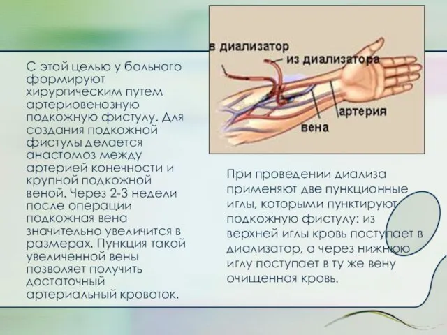 При проведении диализа применяют две пункционные иглы, которыми пунктируют подкожную фистулу: