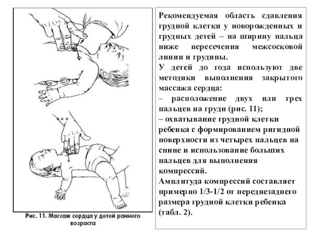 Рекомендуемая область сдавления грудной клетки у новорожденных и грудных детей –