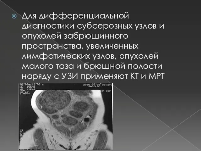 Для дифференциальной диагностики субсерозных узлов и опухолей забрюшинного пространства, увеличенных лимфатических