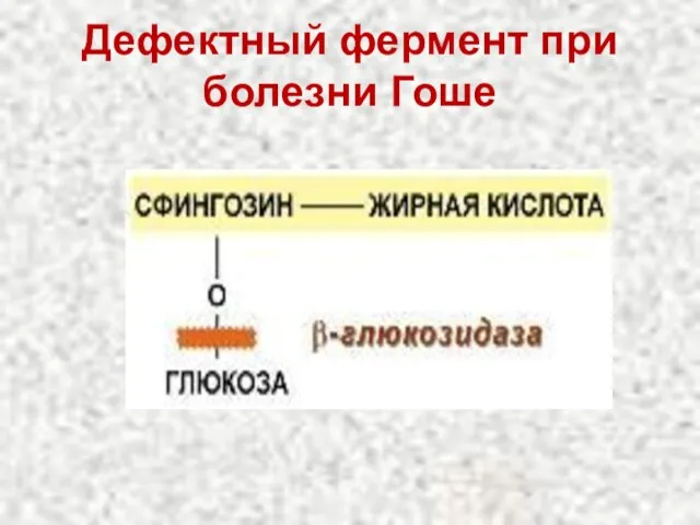 Дефектный фермент при болезни Гоше