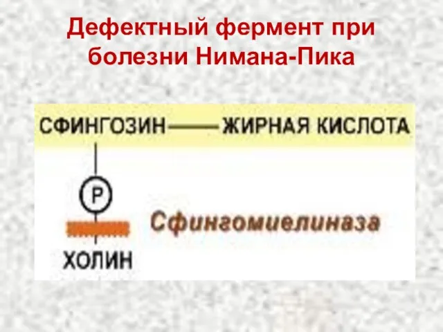 Дефектный фермент при болезни Нимана-Пика