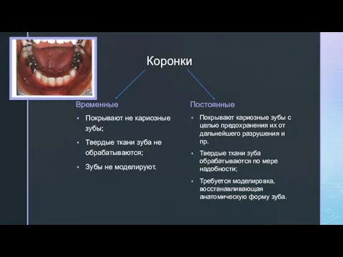 Коронки Временные Покрывают не кариозные зубы; Твердые ткани зуба не обрабатываются;