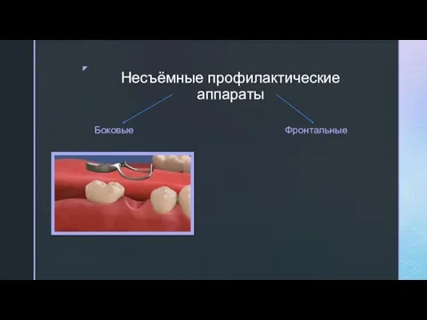 Несъёмные профилактические аппараты Боковые Фронтальные