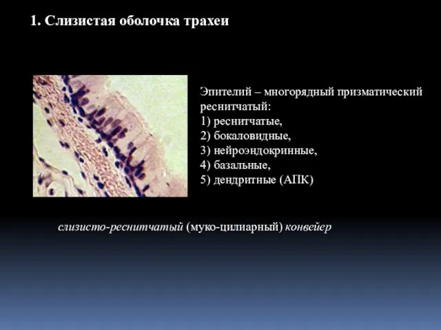 1. Слизистая оболочка трахеи Эпителий – многорядный призматический реснитчатый: 1) реснитчатые,