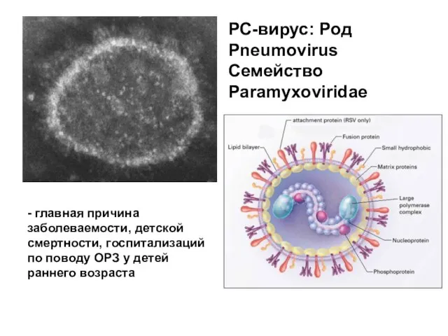 РС-вирус: Род Pneumovirus Семейство Paramyxoviridaе - главная причина заболеваемости, детской смертности,