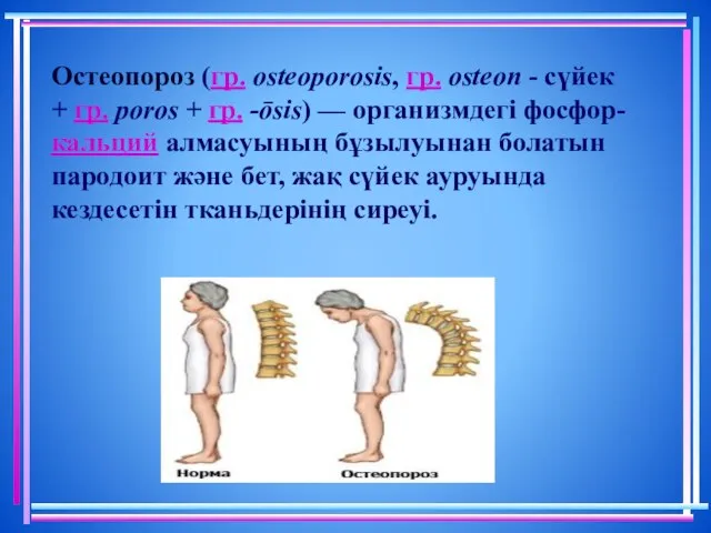 Остеопороз (гр. osteoporosis, гр. osteon - сүйек + гр. poros +