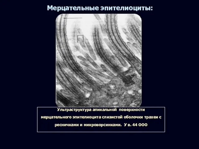 Мерцательные эпителиоциты: Ультраструктура апикальной поверхности мерцательного эпителиоцита слизистой оболочки трахеи с