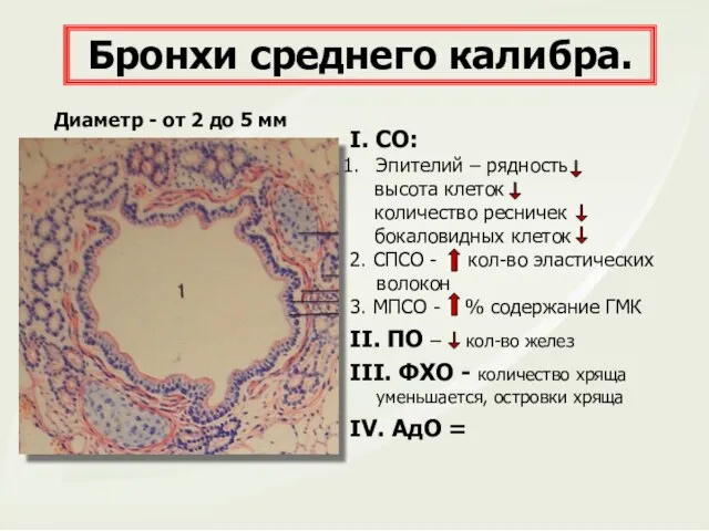 I. СО: Эпителий – рядность высота клеток количество ресничек бокаловидных клеток