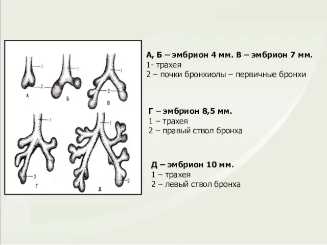 А, Б – эмбрион 4 мм. В – эмбрион 7 мм.