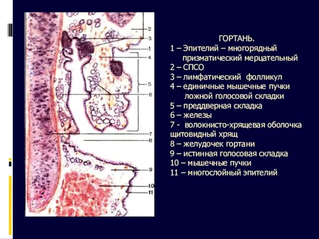 ГОРТАНЬ. 1 – Эпителий – многорядный призматический мерцательный 2 – СПСО