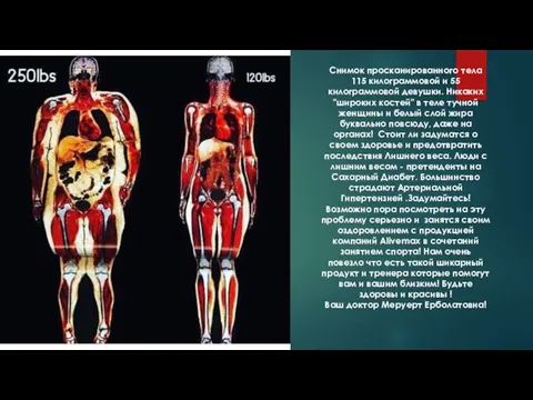 Снимок просканированного тела 115 килограммовой и 55 килограммовой девушки. Никаких "широких