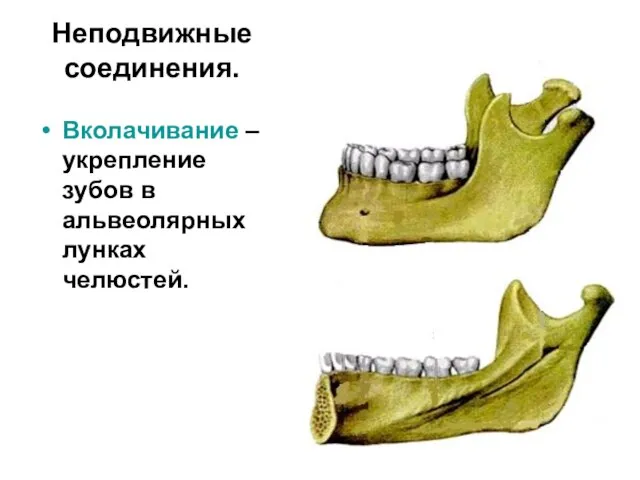 Неподвижные соединения. Вколачивание – укрепление зубов в альвеолярных лунках челюстей.