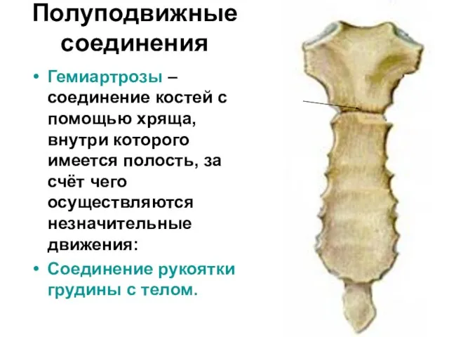 Полуподвижные соединения Гемиартрозы – соединение костей с помощью хряща, внутри которого