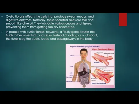 Cystic fibrosis affects the cells that produce sweat, mucus, and digestive